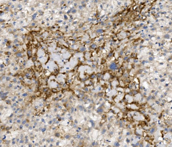 Anti-CCR2 Antibody