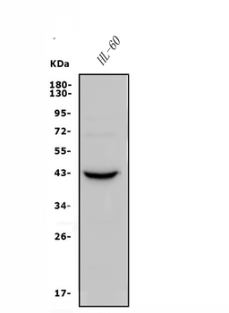 Anti-CCR2 Antibody