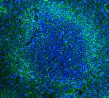 Cd2 Rabbit Polyclonal Antibody