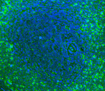 Anti-Cd2 Antibody