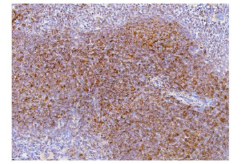 Anti-Cd2 Antibody
