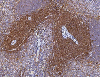Anti-Cd2 Antibody