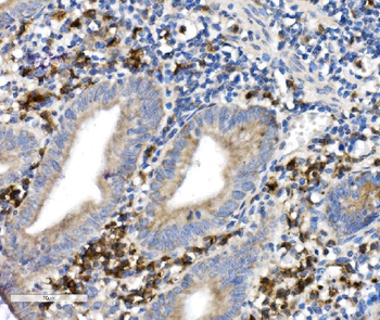 Anti-CD38 Antibody