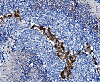 Anti-CD38 Antibody