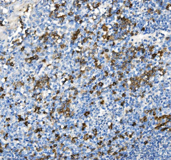 Anti-CD38 Antibody