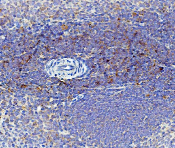Cd59 Rabbit Polyclonal Antibody