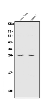 Anti-CINP Antibody