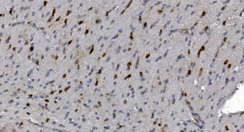 Anti-Alpha B Crystallin/CRYAB Antibody