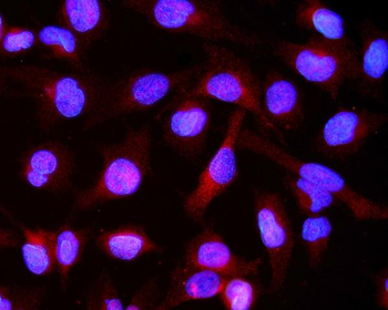 Anti-Alpha B Crystallin/CRYAB Antibody