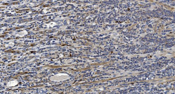 Anti-Alpha B Crystallin/CRYAB Antibody