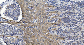 Anti-Alpha B Crystallin/CRYAB Antibody