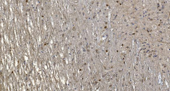 Anti-Alpha B Crystallin/CRYAB Antibody