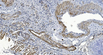 Anti-Alpha B Crystallin/CRYAB Antibody