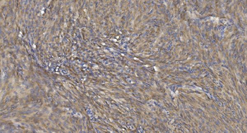 Anti-Alpha B Crystallin/CRYAB Antibody