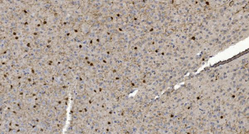 Anti-Alpha B Crystallin/CRYAB Antibody