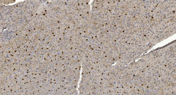 Anti-Alpha B Crystallin/CRYAB Antibody