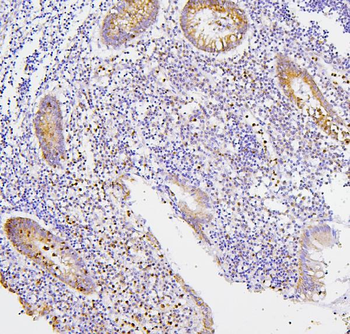 Anti-CXCR2 Antibody
