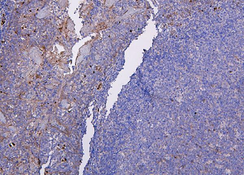 Anti-CXCR2 Antibody