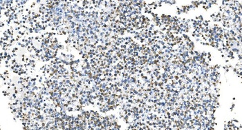 DRP1/DNM1L Antibody