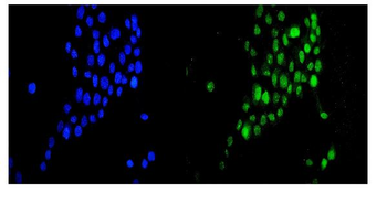 Anti-DR1 Antibody