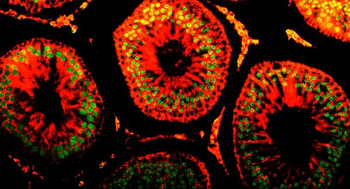Anti-DR1 Antibody