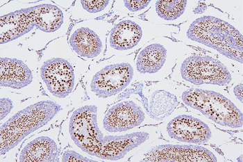 Anti-DR1 Antibody