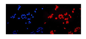 Anti-ERM/Etv5 Antibody