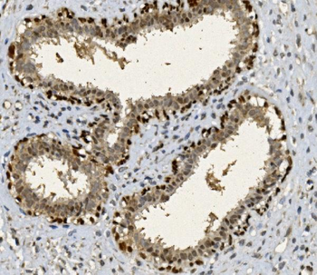 Anti-FOXP1 Antibody