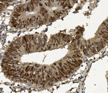 Anti-FOXP1 Antibody