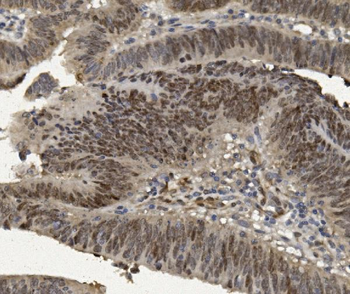 Anti-FOXP1 Antibody