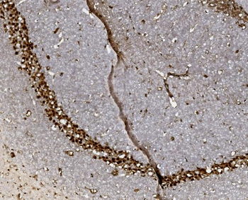 Anti-FOXP1 Antibody