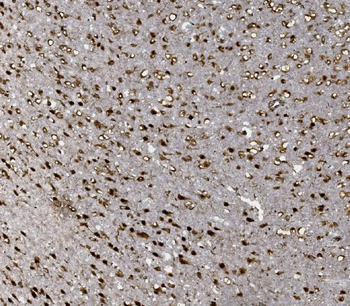 Anti-FOXP1 Antibody
