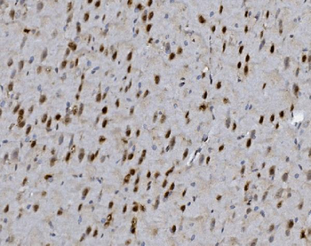 Anti-FOXP1 Antibody