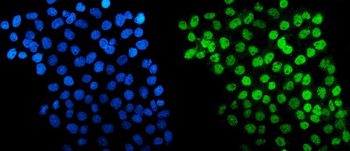 Anti-HDAC5 Antibody