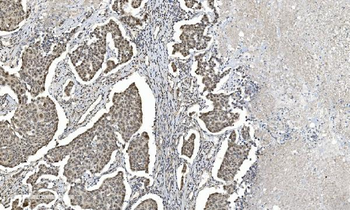 Anti-HDAC5 Antibody