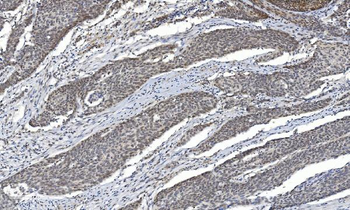 Anti-HDAC5 Antibody