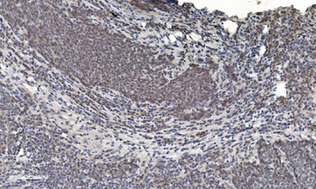 Anti-HDAC5 Antibody
