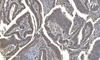 Anti-HDAC5 Antibody