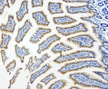 Anti-HDAC5 Antibody