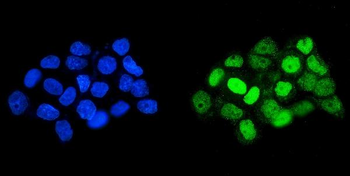 Anti-HOXD11 Antibody