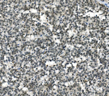 Anti-HOXD11 Antibody