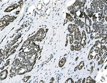 Anti-HOXD11 Antibody