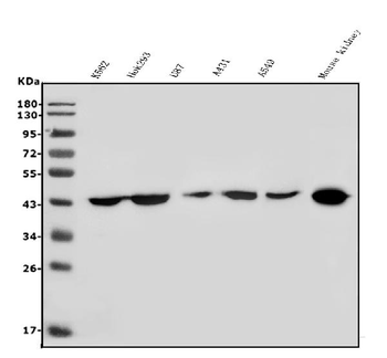 Anti-HOXD11 Antibody