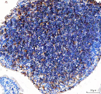 Anti-GILT/IFI30 Antibody