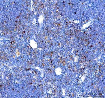 Anti-GILT/IFI30 Antibody