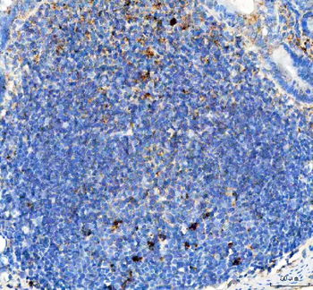 Anti-GILT/IFI30 Antibody