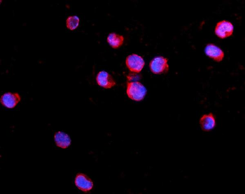 IL2 Receptor gamma/IL2RG Antibody