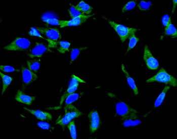 Anti-Inhibin alpha/INHA Antibody