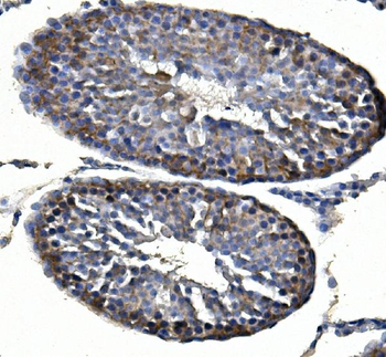 Anti-Inhibin alpha/INHA Antibody