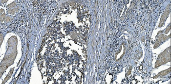 Anti-MCU Antibody